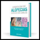 Dermatologia Das Alopecias E Estudo Dos Cabelos