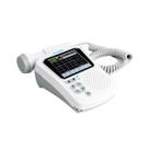 Detector Fetal de Mesa FD-310C LCD Colorido e 3 Modos de Exibição - Vcomin