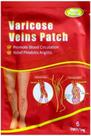Emplastro para varizes vasos veias vasculite diminuição inchaço Emplastro para varizes vasos veias vasculite diminuição inchaço
