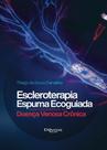 Escleroterapia com espuma ecoguiada - DI LIVROS EDITORA LTDA Escleroterapia com espuma ecoguiada - DI LIVROS EDITORA LTDA
