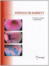 Esofago de Barrett
