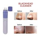 Extrator de Acne e Cravos Vácuo Sucção Facial Profissional Equipamento de Estética Portátil Top