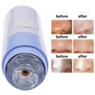 Extrator de Cravos Vácuo Profissional Sucção Facial Limpeza de Pele Portátil Skincare Completo