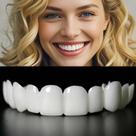 Facetas Dentárias Ajustáveis Sunnydeer 2 Pares Brancas