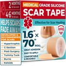 Fita de Silicone para Cicatrizes MYHELP 4x178 cm Reutilizável Grau Médico