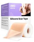 Folhas de cicatrizes de silicone AWD Medical para cicatrizes cirúrgicas 1,6 cm x 60 m