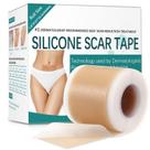 Folhas de cicatrizes de silicone Pumkot Fita de cicatriz de silicone 4,6 cm x 4 m