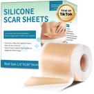Folhas de silicone para cicatrizes Rvlaim para cicatrizes cirúrgicas, quelóides e cesariana