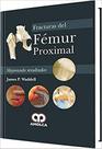 Fracturas del femur proximal (espanhol) Fracturas del femur proximal (espanhol)