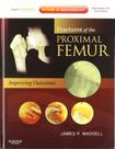 Fractures of the proximal femur: improving outcomes - ELSEVIER (IMPORTADOS)