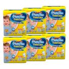 Fralda Descartável MamyPoko Calça Dia & Noite Tamanho XG - 6 Pacotes com 14 Fraldas - Total 84 Tiras Fralda Descartável MamyPoko Calça Dia & Noite Tamanho XG - 6 Pacotes com 14 Fraldas - Total 84 Tiras