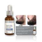 Grandha Crescimento Da Barba Vita Hominis Volcano Power Grandha Crescimento Da Barba Vita Hominis Volcano Power