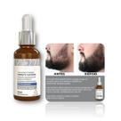 Grandha Crescimento Da Barba Vita Hominis Volcano Power Grandha Crescimento Da Barba Vita Hominis Volcano Power
