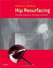 Hip resurfacing - principles, indications - W.B. SAUNDERS Hip resurfacing - principles, indications - W.B. SAUNDERS