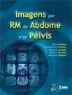 Imagens por Rm do Abdome e da Pelvis