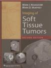 Imaging of Soft Tissue Tumors 2 Edicao - LWW