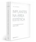 Implantes Na Área Estética Uma Estratégia De Tratamento Passo-A-Passo - Editora Napoleão