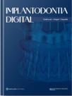 Implantodontia Digital - Napoleão