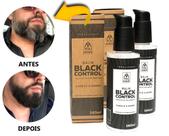 Kit 2 Balm Escurecedor de Barba e Cabelo Black Control You Man - Escurecimento Imediato