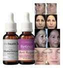 Kit 2 Poderoso Serum Retinol E Hialurônico 30ml