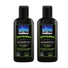Kit 2 Shampoo Antiqueda Masculino Nupill Força Vitalidade e Volume 200ml Kit 2 Shampoo Antiqueda Masculino Nupill Força Vitalidade e Volume 200ml