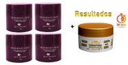 KIT 4 Und Desodorante Pierre Alexander Creme Antitranspirante + Parafina Lorkin