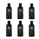 Kit 6 Shampoo Antiqueda Masculino Nupill Força Vitalidade e Volume 200ml