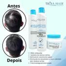Kit Crescimento Difusão Capilar Tróia Hair 300 ml