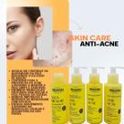 Kit Facial Rhenuks Anti-Acne 4 Itens - Rhenuks