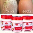 Kit Hidratante Pedreiro para Pés Rachados e Ressecados 720g (3 produtos) - Dt Fixa Cosmeticos