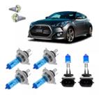 Kit Lâmpadas Super Brancas Veloster Efeito Xenon