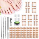 Kit para Remoção de Unha Encravada com Tiras Corretoras, Adesivo Curvo para Unhas, Lixa e Ferramentas de Pedicure para Mulheres e Homens