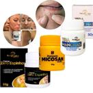 Kit Pomada Tira Mancha + Creme Zero Espinha + Pomada Micosan