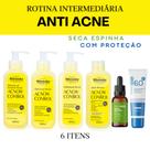 Kit Skincare Anti Acne/Oleosidade Rhenuks Sérum Secativo Protetor Solar FPS60 Sem COR Dermachem