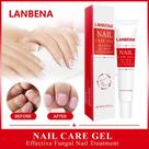 Lanbena Nail Care Gel Tecnologia de Proteção de Unha Pro
