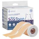 Lençóis de silicone para cicatrizes ZETHYR STREET Medical Grade (2x30cm)