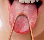 Limpador de Língua Rosa DentLimp