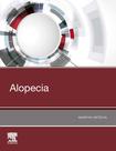 Livro - Alopecia