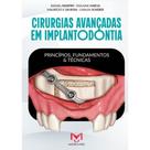 Livro Cirurgias Avançadas Em Implantodontia Princípios, Fundamentos e Técnicas