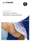 Livro - Conceitos e Casos no Tratamento da Pseudoartrose Livro - Conceitos e Casos no Tratamento da Pseudoartrose