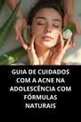 Livro Guia De Cuidados Com A Acne Na Adolescência Com Fórmulas Naturais Livro Guia De Cuidados Com A Acne Na Adolescência Com Fórmulas Naturais