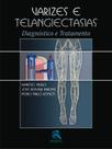 Livro - Varizes e Telangiectasias Livro - Varizes e Telangiectasias