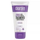 Loção Facial de Tratamento Cosmético para Acne 40ml - AVON
