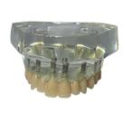 Macro Modelo Protocolo Superior c/ 08 Implantes Sem Gengiva