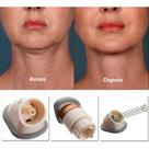 Massageador de pescoco com 3 molas facial redutor aparelho de exercicios tira papada tonificador que