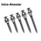 Mini Implante Ortodôntico Para Ancoragem Absoluta - Morelli Mini Implante Ortodôntico Para Ancoragem Absoluta - Morelli