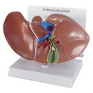 Modelo Anatômico de Fígado GPI Anatomicals 20x14x14 cm com Cálculos Biliares Modelo Anatômico de Fígado GPI Anatomicals 20x14x14 cm com Cálculos Biliares