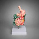 Modelo Anatômico do Sistema Digestivo com Patologias, com estômago seccionável Modelo Anatômico do Sistema Digestivo com Patologias, com estômago seccionável
