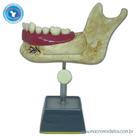 Modelo Hemi Mandibula de Jovem - Macro Modelos