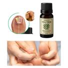 Óleo Essêncial de Melaleuca Tea Tree 20ml